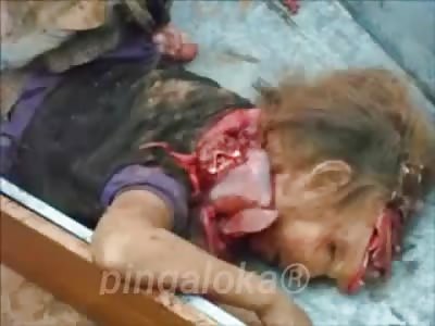Little girl crushed by truck .