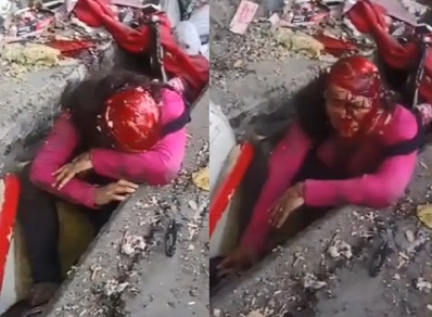 HOLY SHIT! Chinese Lady Scalped Completely 