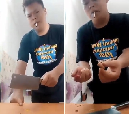 Dude Chops His Finger With A Butcher Knife