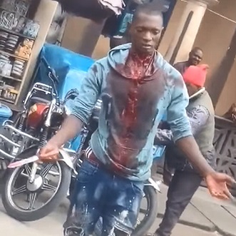 Young Man Cuts His Throat And Stabs Himself In Apparent Attempt To Commit Suicide
