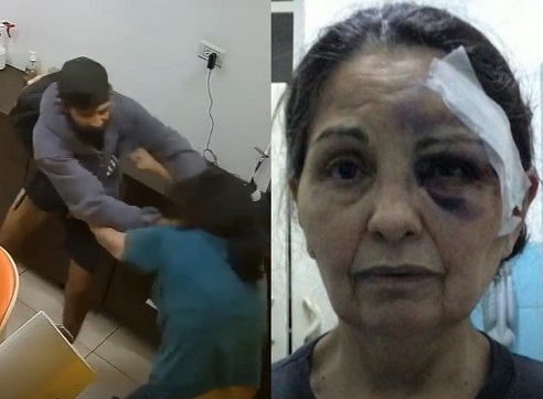 Elderly Woman Brutally Attacked & Robbed In Argentina
