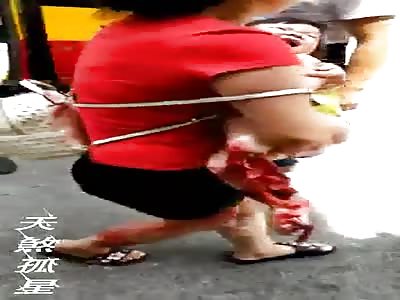 Kid loses legs in accident 