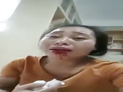Ugly Asian bitch abused 