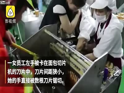 Woman loses her fingers in a bread slicing machine