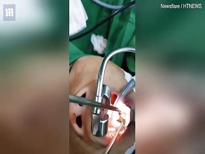 Wriggling leech is removed from inside a woman's throat