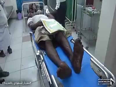 21 killed by Saudi UAE strikes on OkraOkro farm in Hodeidah West Yemen