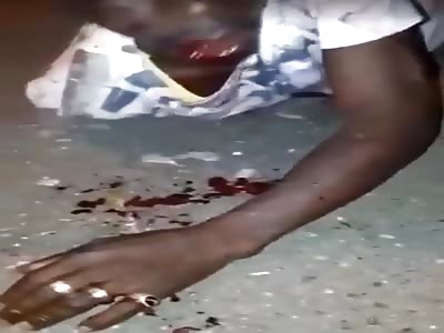 Jamaican Dude Drunk Off Rum Knocks His Tooth Out!