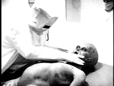 Original Alien Autopsy (1995)