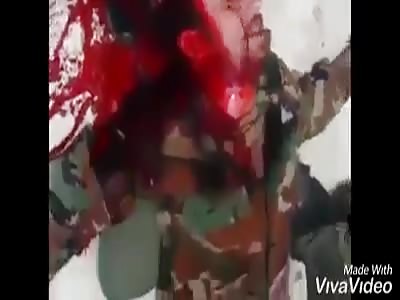 syrian soldier bleeding to death