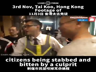 Hong Kong politician had his ear bitten off ï¼ˆpart 1ï¼‰