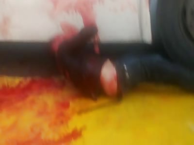 OUCH:bus thief in pool of blood