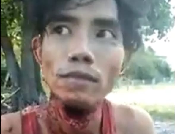 Young Man With Nasty Gash in His Throat.