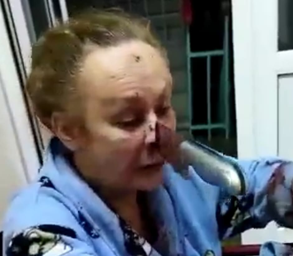 Woman Stabbed In The Face During Drunken Quarrel (Clean Version)