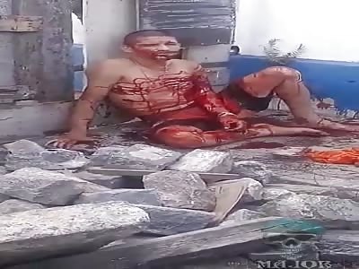 (full video) man brutally attacked
