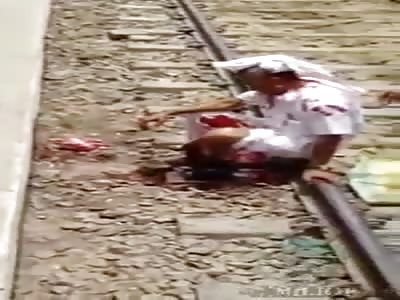 man loses one leg on train tracks