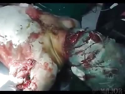 normal day in Syrian hospital