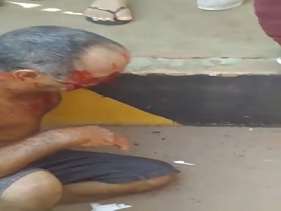 Old man injuries after accident
