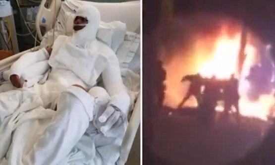INNOCENT NJ Man Beaten While On Fire by Police