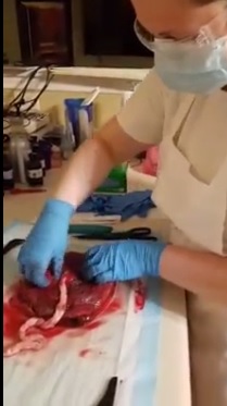 Woman Makes Chocolates With Her Placenta (AND EATS IT!)