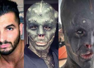 Body Modification Fanatic Removed His Upper Lip, Ears & Nose To Look Like An Alien!