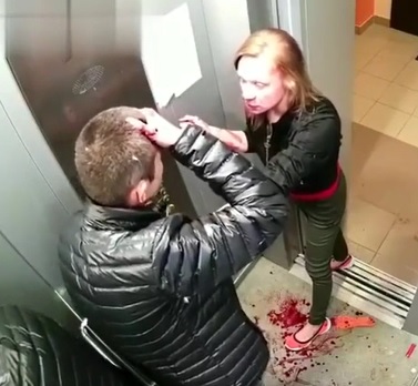 HOLY SHIT: Couple Beat Each Other Bloody Then Make Up.