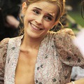 AWESOME: Emma Watson Wardrobe Malfunction