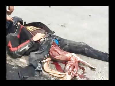 Rider Alive with his Entire Leg Ripped to Shreds in total Shock