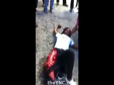 Short Video of Woman with Leg Skinned in Shock on the Street 