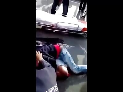 Man Lies in the Street in Total Agony with His Leg and Arm Ripped Apart