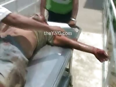 Man in Horrible Agony Hacked in the Head with a Machete