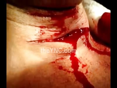 Biker with his Neck Sliced Open Being Asked to Breathe..