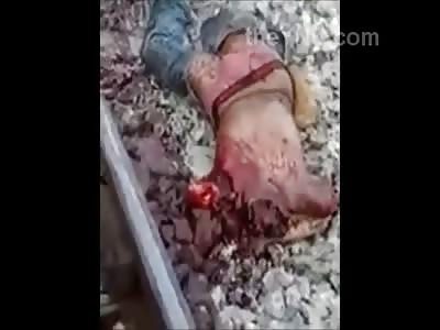 Gruesome Result of a Horrific Train Accident