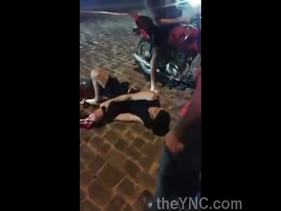 Man With Leg Crushed Waiting For Help.. Total Agony