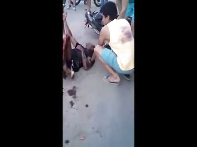 Man in Total Agony with his Leg Shredded on the Street Begs for Help 
