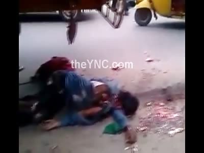 Man Arm Ripped Off Dead Under the Wheel of a Truck