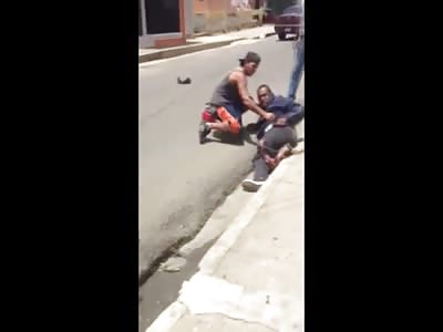 Dude Just Takes Pics Of Man in Total Agony with his Leg Ripped Off