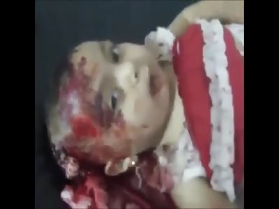 Shocking Video Shows a Baby Still Alive With Pieces of Brain Exposed.