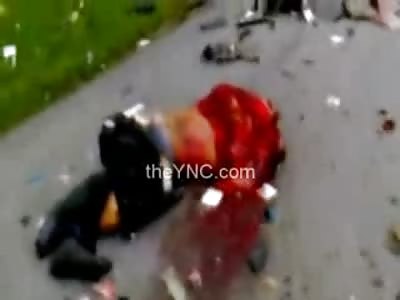 Disgusting Fetal Position Carnage From Accident