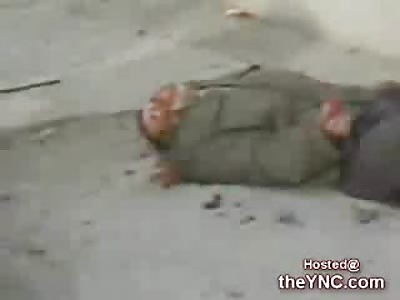 Dying Iraqi Man vomiting Blood