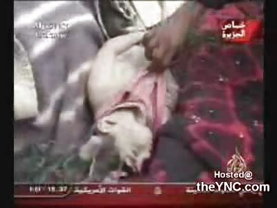 Horrific Head Wound on a Dead Iraqi Child (18+ Only)