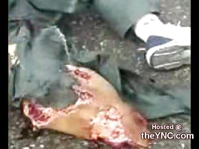 Cell Phone Footage Shows Gory Fatal Head Injury after a Bike Accident (Graphic Warning 18+ Only)