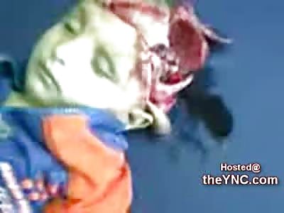 Shocking Video shows a Young Child with a Horrific Head Wound (18 + only!) 