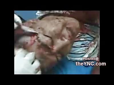 Screaming Man Head Cracked Open Skin Flapping and in a LOT of Pain