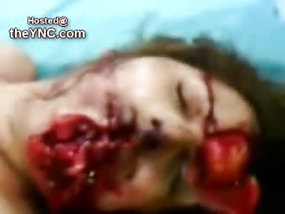 HORRIBLE: Female wide Open Mouth Wound tries Speaking to the Cameraman