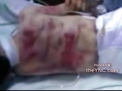 Graphic Video: Baby Beaten to Death by Family Member lies on Life Support