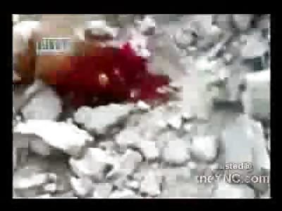 Bodies Ripped apart in Syria 