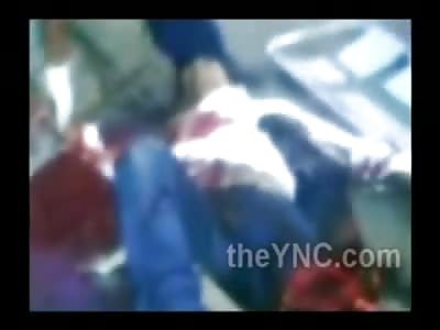 Leg Dismembered in Horrific Accident .... Man in Complete Shock Tries Moving His Leg.....But its not there