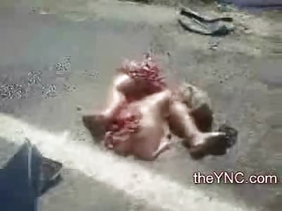 Female Ripped in Half has Legs down the Street....