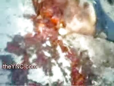 OMG!! Shirtless Man Crushed and Head Popped Off from Gruesome Crash in the Road