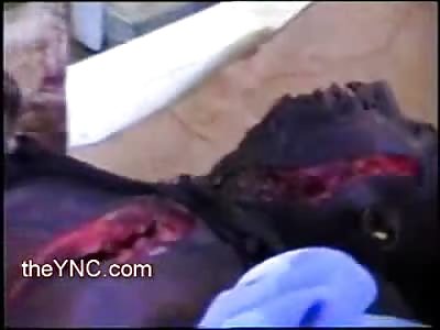 Amateur  Police Video of Man Slashed to Death with Machete with Wounds All over his Body
